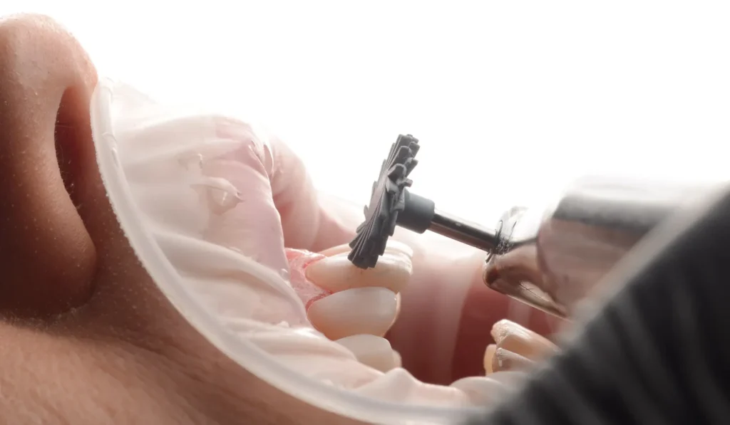 پالیش کامپوزیت