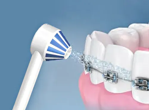 شستوشوی ارتودنسی